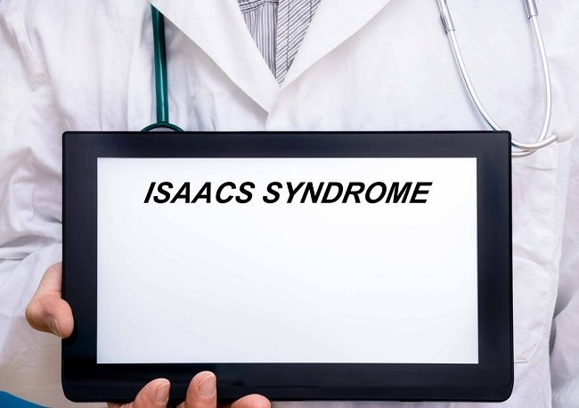 Isaac Syndrome! Gangguan yang Menyebabkan Otot Bergerak Tidak Terkendali