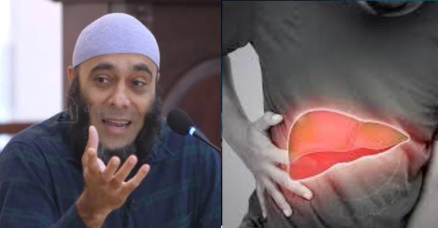 Ternyata Air Kelapa Bisa Menjadi Obat Liver, dr Zaidul Akbar Bagikan Cara Meramunya