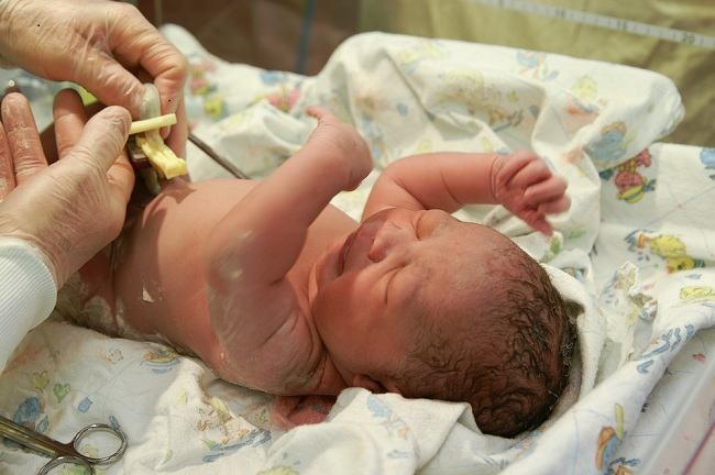 Lotus Birth: Inilah Fakta dan Risiko yang Dapat Terjadi