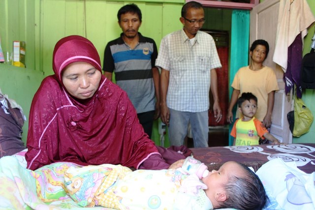 Melihat Kondisi Bayi Penderita Hydrocephalus