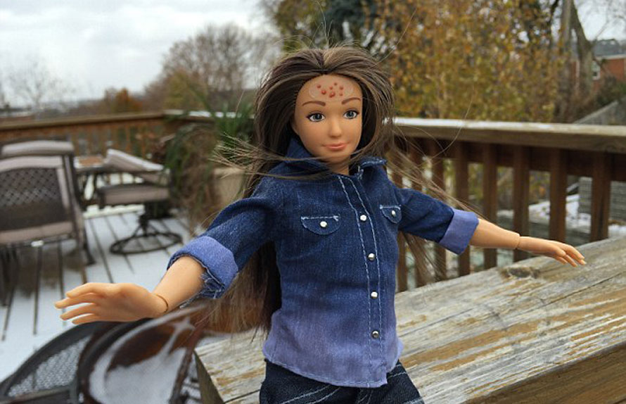 Boneka Berjerawat-Berselulit Saingi Barbie