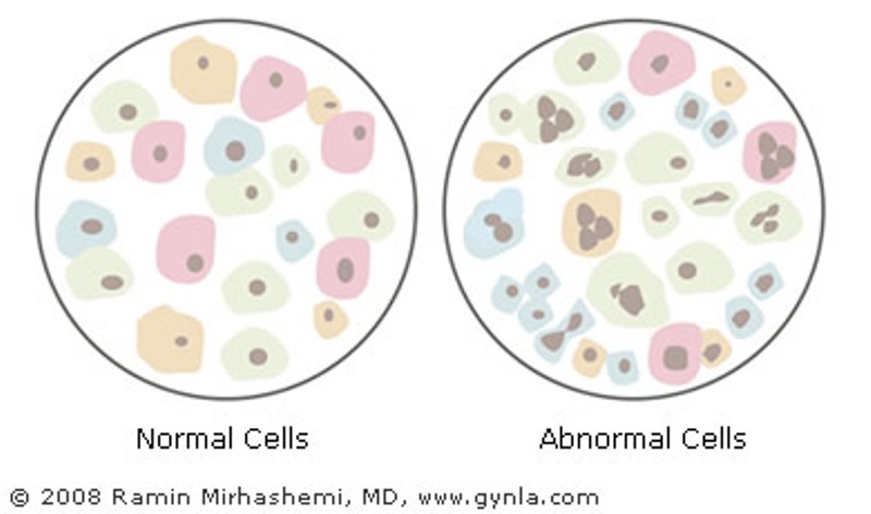 Pemeriksaan IVA dan Pap Smear Serentak