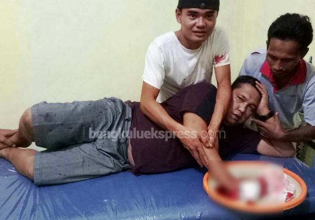 Berkelahi di Warung Tuak, Dua Warga Terkapar