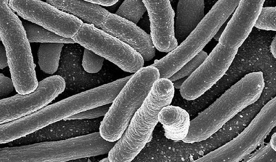Biang Kerok Keracunan  Diduga Bakteri E-Coli
