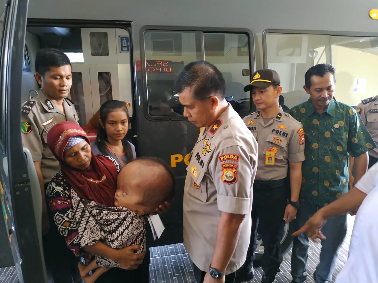 Kapolda Bengkulu Bantu Pengobatan Bayi Penderita Hidrosefalus