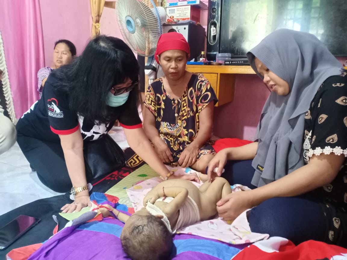 Bayi Penderita Atresia Bilier di Bengkulu Utara Butuh Uluran Tangan