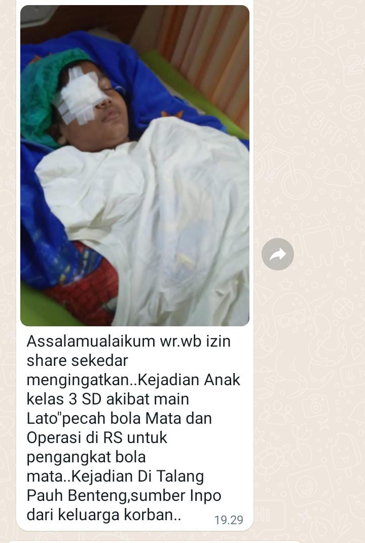 Beredar Kabar Siswa di Bengkulu Tengah Pecah Bola Mata Akibat Lato-lato, Begini Faktanya