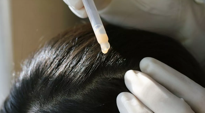 Pentingnya Detoksifikasi untuk Bersihkan Toksin dan Pemulihan Kesehatan Rambut