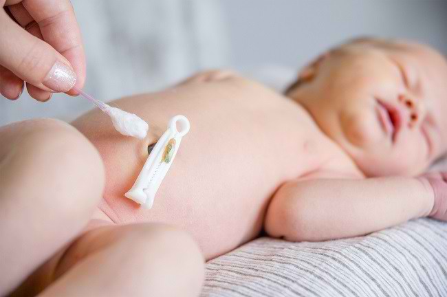 Cara Praktis Menjaga Kebersihan dan Merawat Tali Pusar Bayi