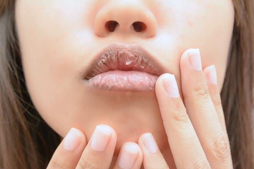  Tampil Tetap Percaya Diri, Berikut 6 Tips Simpel Cegah Bibir Kering dan Pecah-pecah Saat Berpuasa