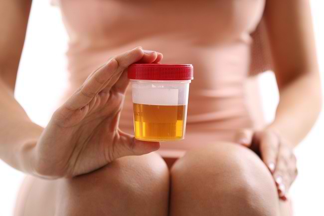 Terapi Urine! Antara Mitos dan Faktanya dari Sisi Medis