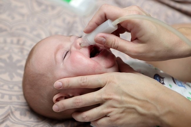 5 Cara Mudah Mengatasi Hidung Tersumbat pada Bayi