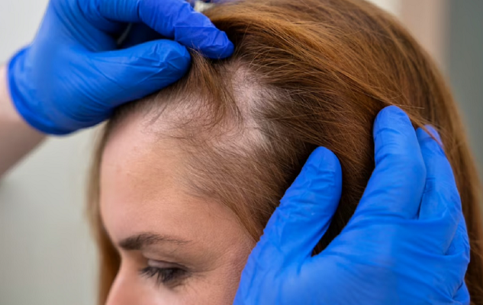 Polusi Udara Ternyata Berpengaruh Terhadap Kesehatan Rambut, Begini Cara Mengatasinya