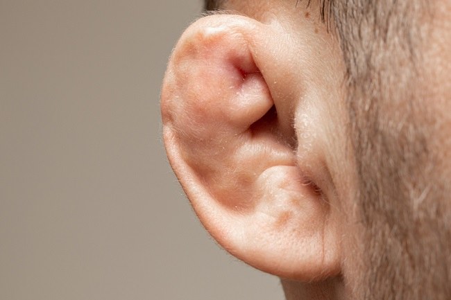 Cauliflower Ear: Kondisi Telinga Menyerupai Kembang Kol