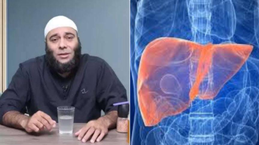 Hati-hati Bila Tubuh Memunculkan Tanda Ini, dr Zaidul Akbar: Berarti Liver Sedang Bermasalah