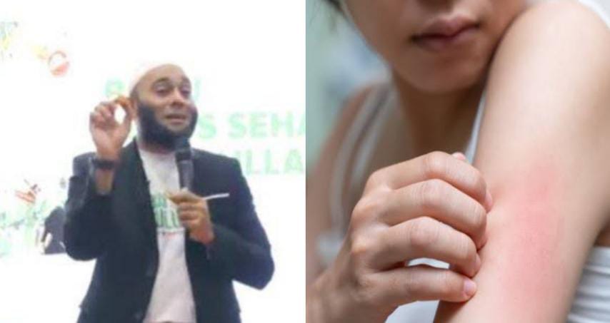 Gatal-gala Langsung Minggat dari Badan, dr Zaidul Akbar Ungkap Rahasia Bahan Sederhana Ini