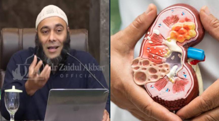 Agar Ginjal Tetap Sehat, dr Zaidul Akbar Jelaskan 8 Kebiasaan yang Berdampak Buruk ke Ginjal