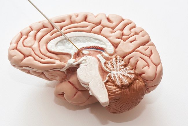 Deep Brain Stimulation: Ini yang Perlu Diketahui