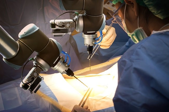 Mengenal Apa Itu Robotic Spine Surgery