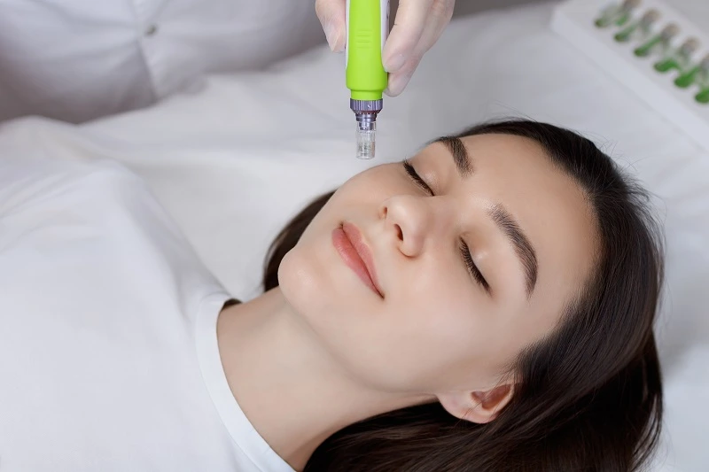 Manfaat Microneedling untuk Kecantikan dan Prosedurnya