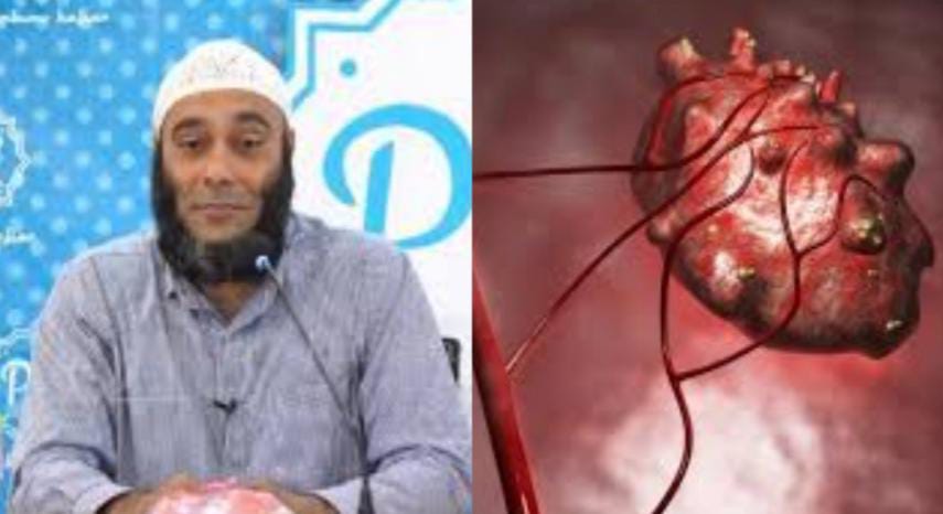 Selain Enak, Buah Ini Ampuh Mengusir Sel Tumor, Berikut Penjelasan dr Zaidul Akbar