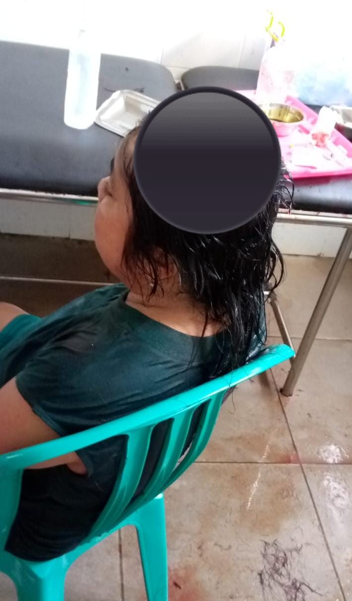 Anak Durhaka di Bengkulu Pukuli Ibu Kandung Hingga Dilarikan ke Rumah Sakit, Pelaku Sudah Ditangkap