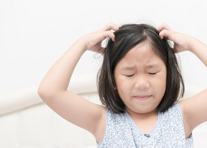 Jangan Panik! Begini Cara Mengatasi Kutu Rambut pada Anak yang Menyebabkan Gatal