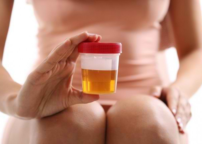 Ini Dia Mitos Seputar Terapi Urine dan Faktanya dari Sisi Medis