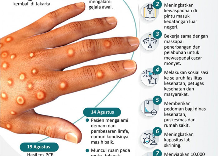 INFOGRAFIK: Laporan kasus cacar monyet pertama di Indonesia