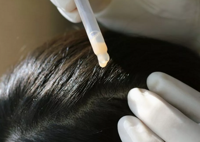 Pentingnya Detoksifikasi untuk Bersihkan Toksin dan Pemulihan Kesehatan Rambut