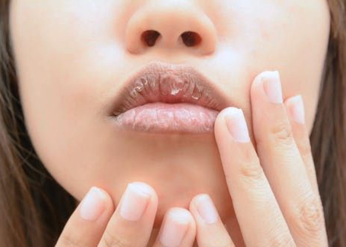  Tampil Tetap Percaya Diri, Berikut 6 Tips Simpel Cegah Bibir Kering dan Pecah-pecah Saat Berpuasa