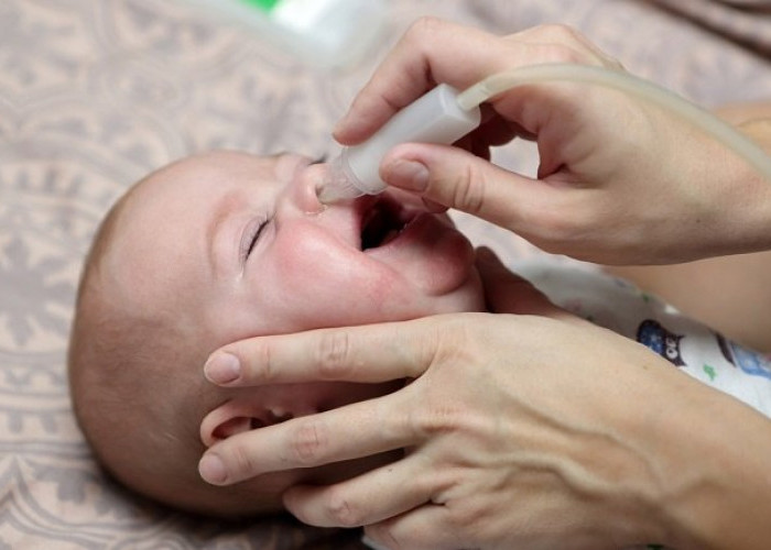 5 Cara Mudah Mengatasi Hidung Tersumbat pada Bayi