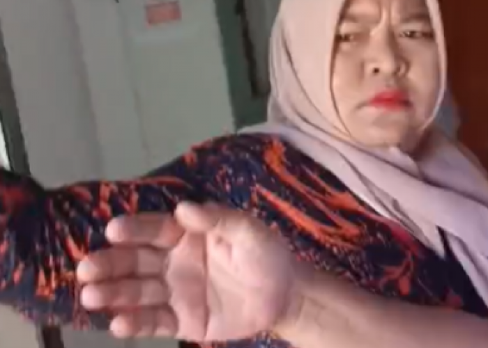 Wartawan Bengkulu Ekspress Dipukul Kades Saat Konfirmasi Isu Dinasti Keluarga