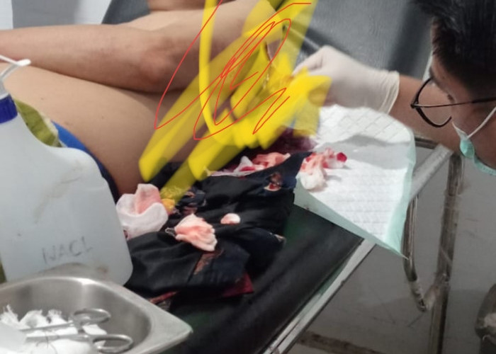Pulang dari Pesta, Kades Padang Genteng Dibacok OTK, Pelaku Diburu Polisi