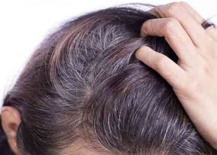 5 Bahan Alami Hilangkan Rambut Ubanan Tanpa Efek Samping 