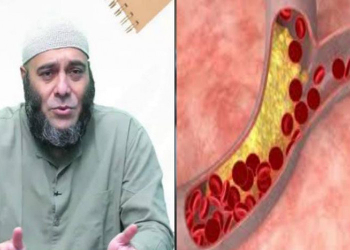 Agar Darah dan Pembuluh Darah Bebas Dari Racun dan Kotoran, dr Zaidul Akbar Sarankan Konsumsi Buah Ini