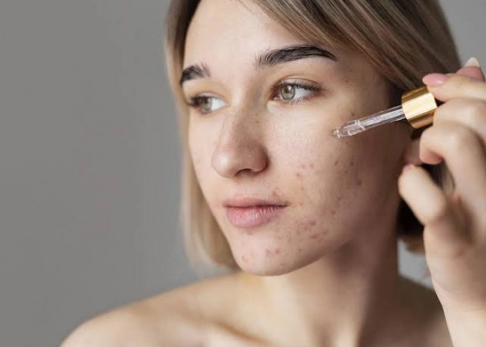 Bantu Hilangkan Flek Hitam, Daftar Skincare Berikut Bisa Dicoba 