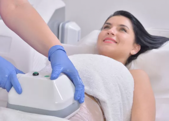 Cryolipolysis, Teknologi Menghilangkan Lemak di Bawah Kulit