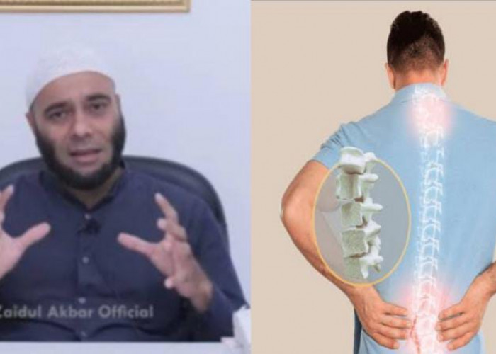 5 Makanan Ini Ampuh untuk Mencegah Tulang Keropos, Berikut Penjelasan dr Zaidul Akbar