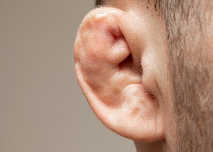 Cauliflower Ear: Kondisi Telinga Menyerupai Kembang Kol