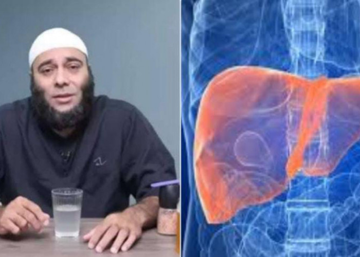 Hati-hati Bila Tubuh Memunculkan Tanda Ini, dr Zaidul Akbar: Berarti Liver Sedang Bermasalah