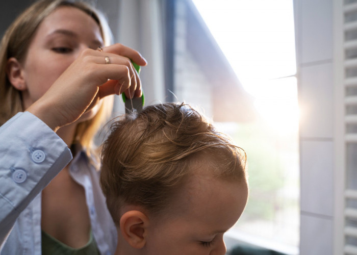 Rambut Bayi Rontok, Kenali Penyebab dan Cara Mengatasinya