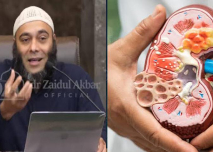 Agar Ginjal Tetap Sehat, dr Zaidul Akbar Jelaskan 8 Kebiasaan yang Berdampak Buruk ke Ginjal