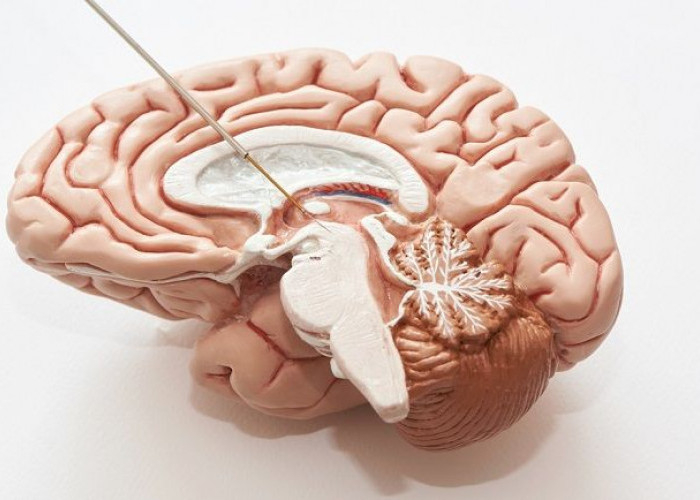 Deep Brain Stimulation: Ini yang Perlu Diketahui