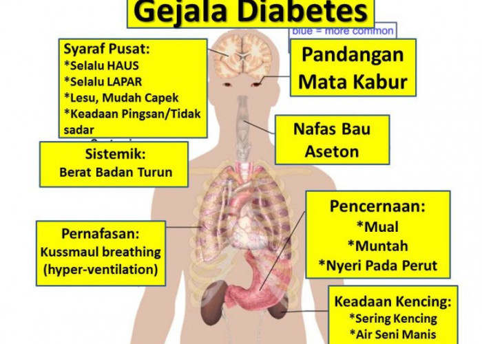 Jalani Puasa Sehat dengan Mengurangi Gula, Bagaimana Caranya?