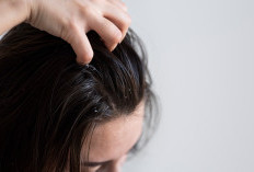 Rambut Berketombe dan Gatal? Ini Tips Perawatan yang Bisa Dicoba